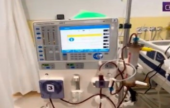 Plasmapheresis